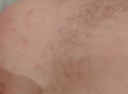 Masturbation