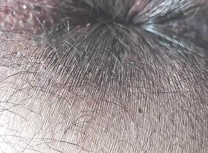 Face Farting POV HD