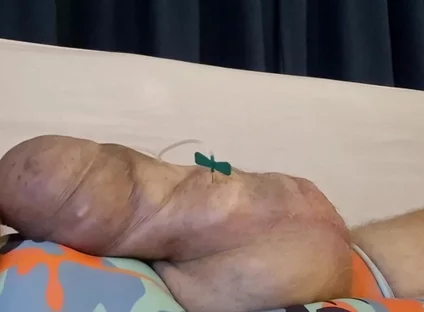 What a Big Obscene Package of Silicone Meat