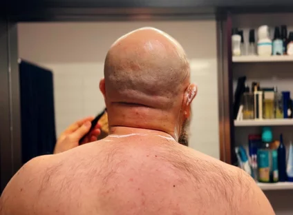 Shave Bald Head and Worship