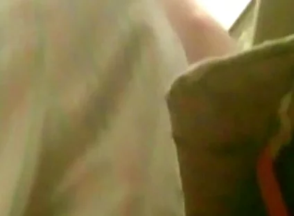 A Young Guy Is Sitting on a Chair with Anal Prolapse