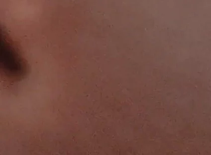 Amazing Closeup of the Widened Hole!!