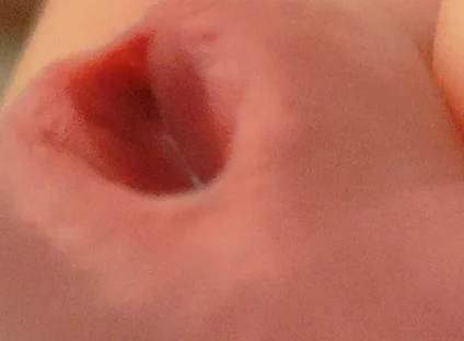 Amazing Closeup of the Widened Hole!!