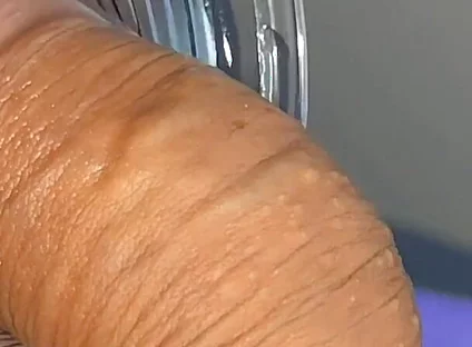 Mysterious Solution Inserted Into the Wrinkled Cock.