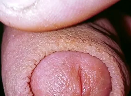 Caress and Suck a Small