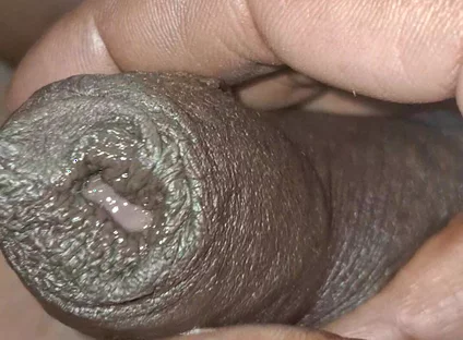 Playing with My Penis