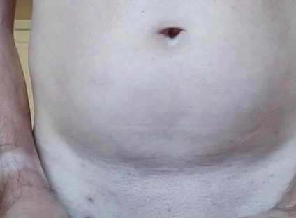 Dilatator