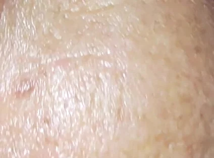 Milk Bath