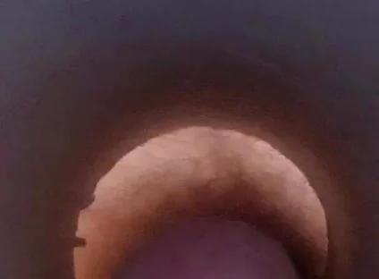 Tunnel Vision