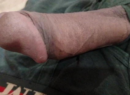 It's so Huge and Tasty.... It's Only for... It's Available for....who Want to Take It