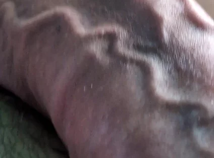 Throbbing