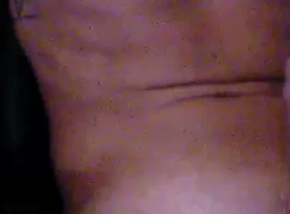 Xfroskax