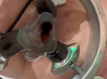 Pouring Hot Candle Wax Into Ass