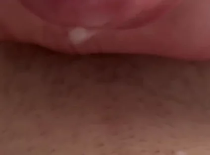 Sperm