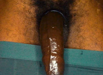 Nutting in Your Mouth