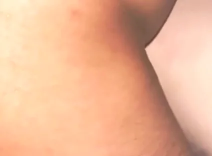 Smooth Skin