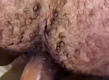 Que Rico Este Culo Peludo Y Tragón