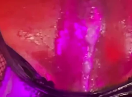 Butthole Training