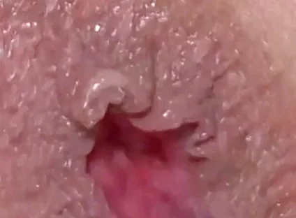 Extreme Closeup Dildo Anal Creampie