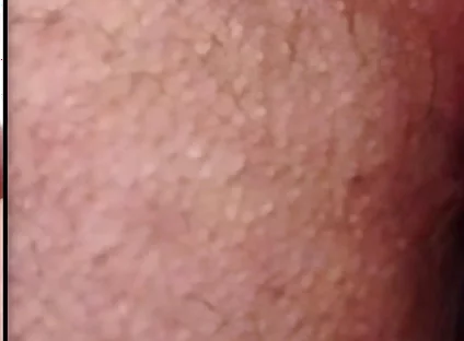 Split-screen Twitching Asshole Dripping with Massive Cum Load