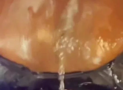 Creampie Ejector