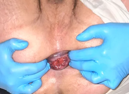 Virgin Asshole Open Anal Compilation Huge Dildo Big Ass