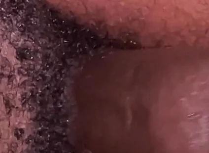 Habesha Dick