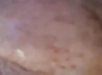 Extreme Fillings Inside My Siliconemeat