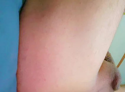 Widening the Ass Opening for Easy Orgasm.