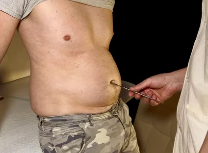 Swollen Perfection - Private Check-up
