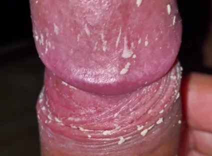Checking My Dirty Dick