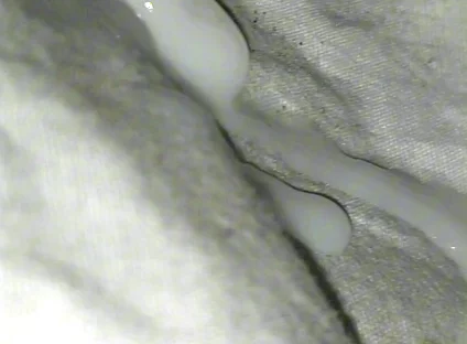 Huge Sperms Out of His Penis, an Young Boy