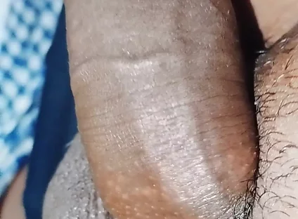 Penis