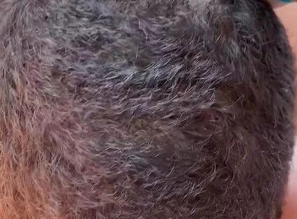 More Sucking