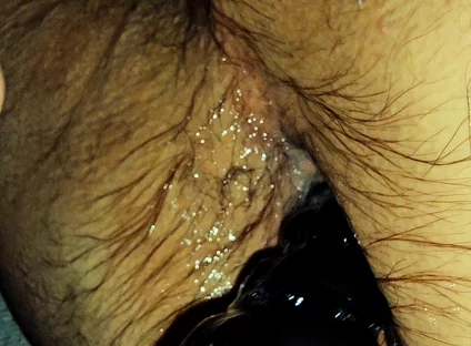 Training My Sloppy Hole