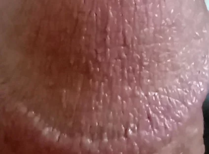My Dick