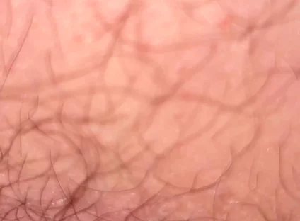 Close up Hairy Hole