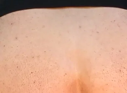 He Enjoys Sucking on His Anal Prolapse
