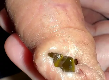 Juicy Small Cock Foreskin Games