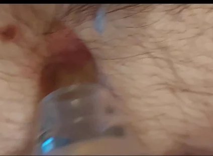 A Close-up Shot of My Belly Button as I Play with It