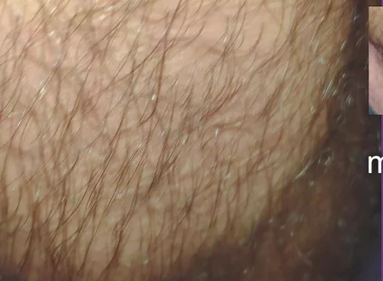 The Texture of the Clothes