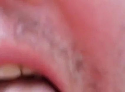 Camera Blunder in the Attempt at Facial Insemination