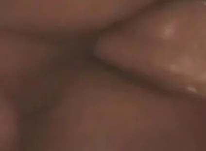 Gaping Anal Prolapse Overflow - Rosebud Pulsing Wide Open