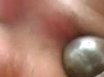 Gaping Anal Rosebud Prolapsing After Deep Stretching Session