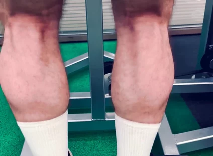 My Legs