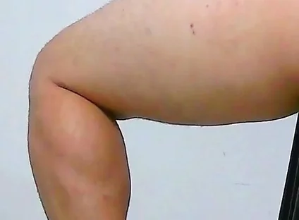 Oh, My Ass Hurts, Apply Ointment