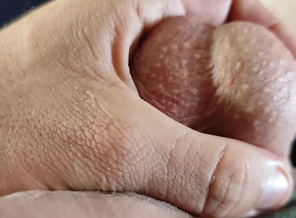 Homemade Stimulator Shoots Electric Shock in the Glans.