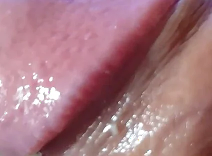 Strange Lumpy Cock with a Gigantic Head.