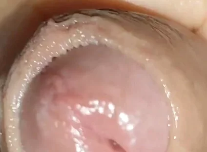 Growth Technique for Soft Cock Sold Out in 30 Seconds.