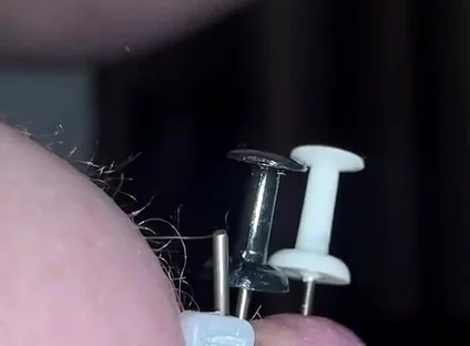Thumtacks hurt